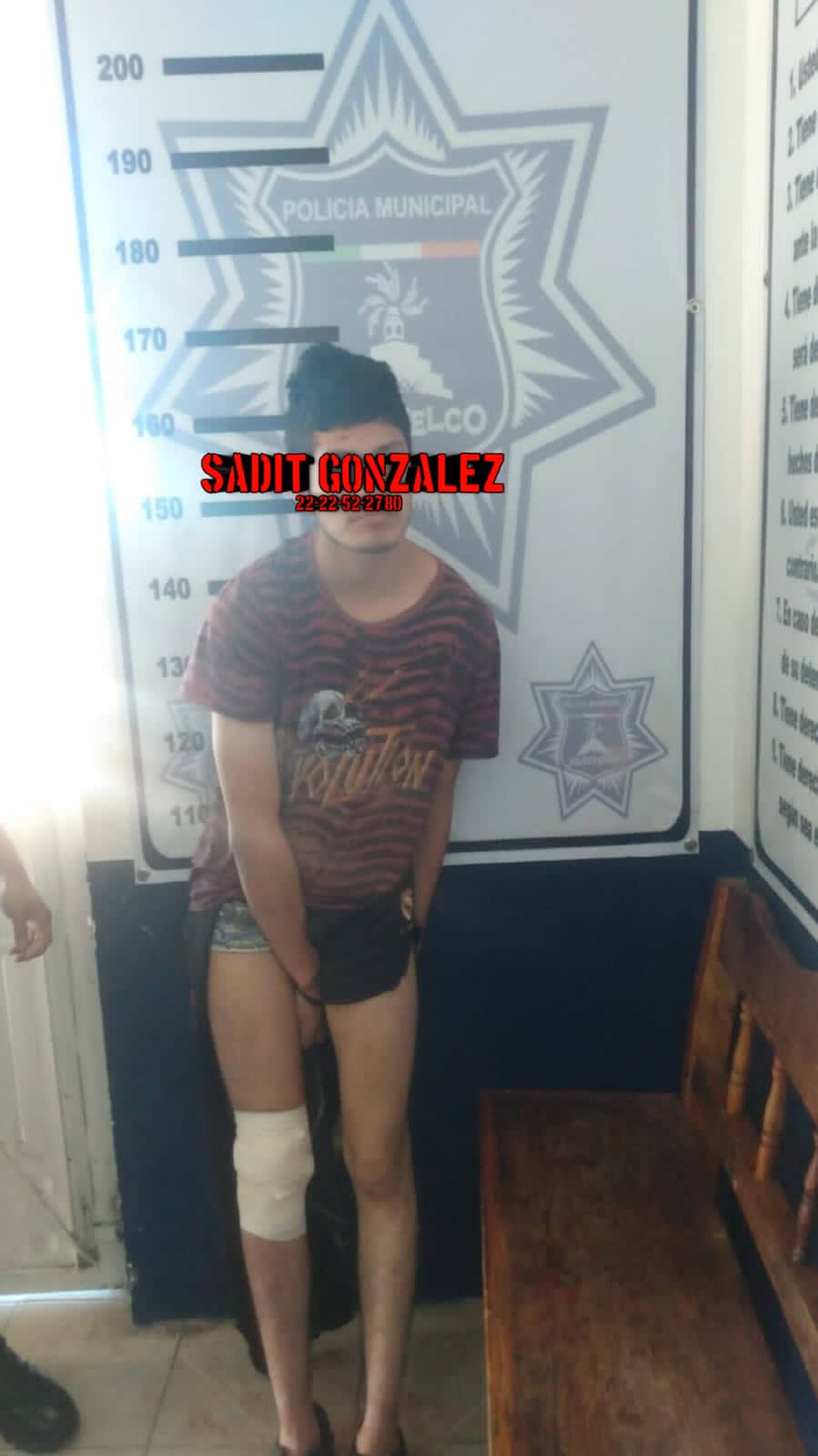 Sujeto  destaso a su hermano de 10 años en Xiutetelco.