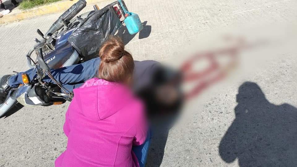 Atacan a balazos a motociclista en Texmelucan, se debate entre la vida y la muerte.
