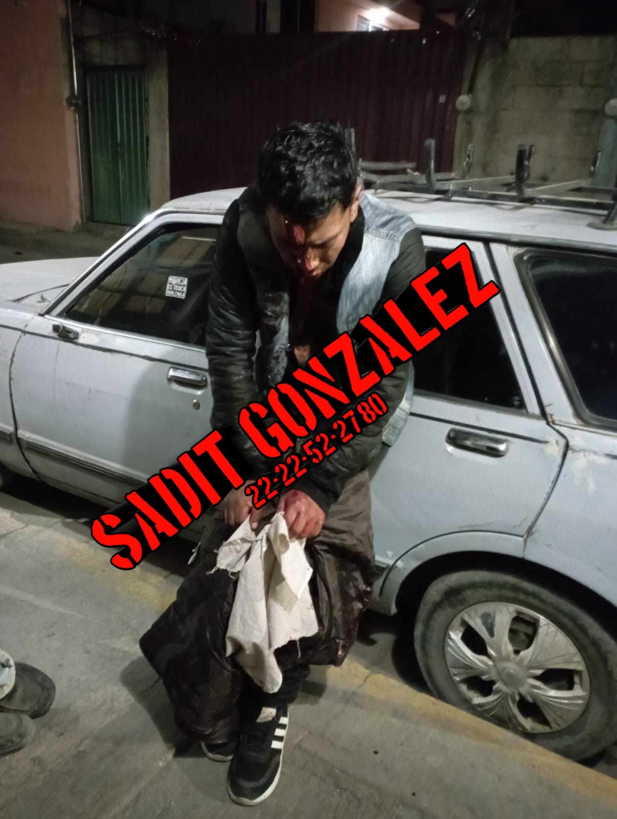 Le pegan un cachazo para asaltarlo en Amozoc