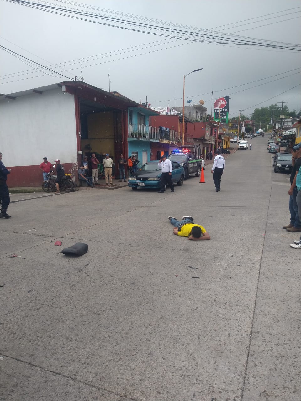 Menor de edad resulta gravemente lesionado al sufrir accidente en motocicleta en el municipio de Hueytamalco.