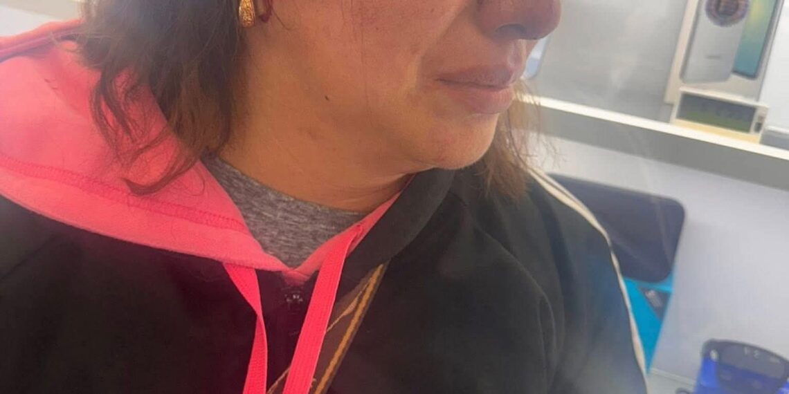 Golpean brutalmente a una mujer en mercado de Atlixco
