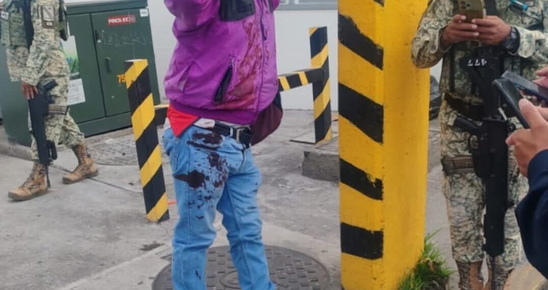 Usuario del transporte público resulta herido de bala en asalto