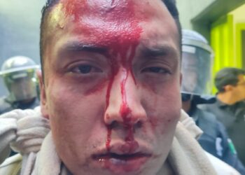 Riña dentro del penal de Tepexi deja varios lesionados