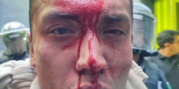 Riña dentro del penal de Tepexi deja varios lesionados