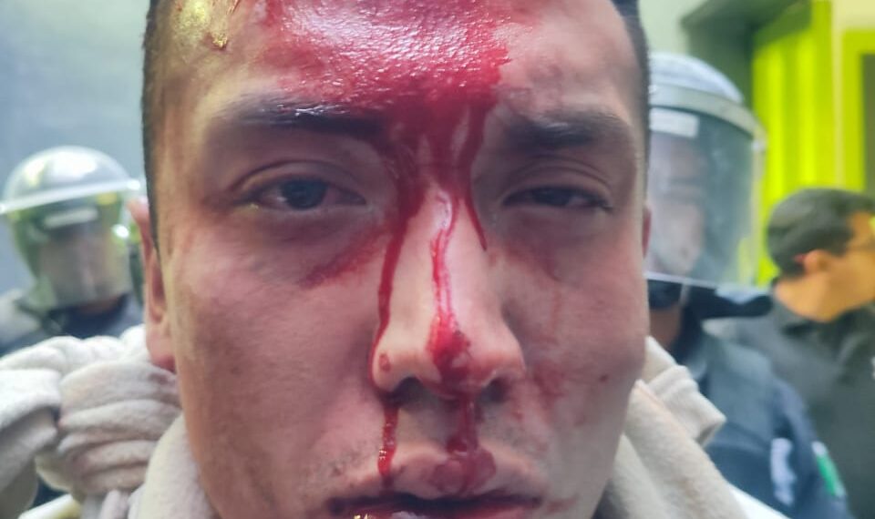 Riña dentro del penal de Tepexi deja varios lesionados