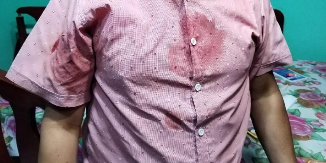 Apuñalan a hombre durante violento asalto en San Baltazar Campeche